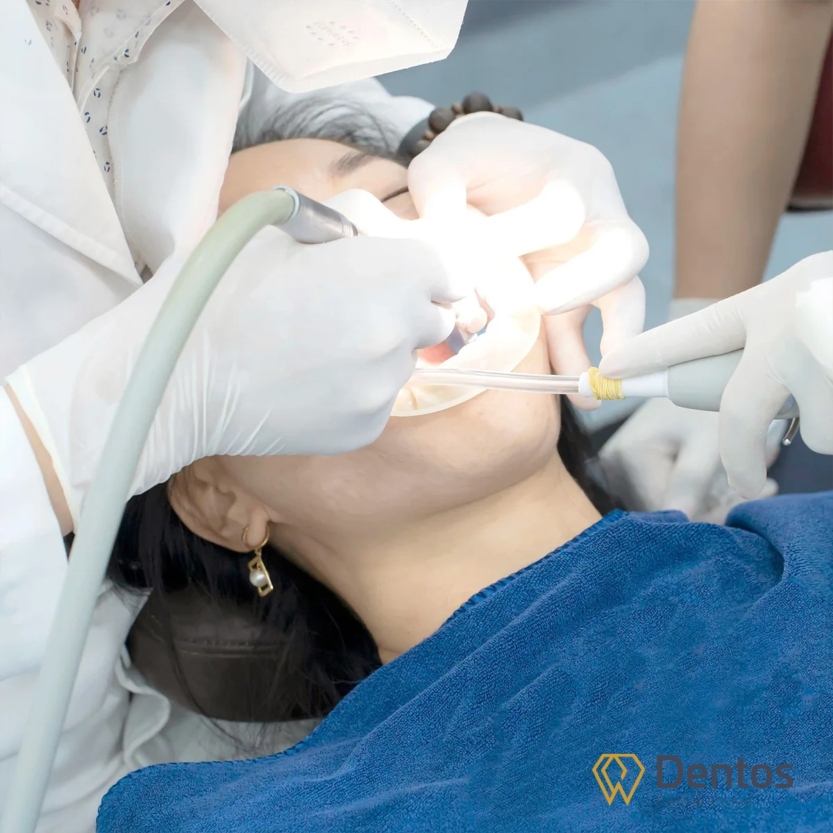 Quy trình làm răng sứ: bác sĩ gây tê và sửa soạn răng